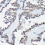 RGS14 Polyclonal Antibody