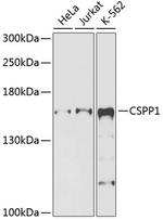 CSPP1 Polyclonal Antibody