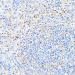 MNF1 Antibody in Immunohistochemistry (Paraffin) (IHC (P))