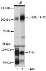 Phospho-B-Raf (Ser445) Polyclonal Antibody