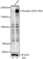Phospho-EGFR (Tyr845) Polyclonal Antibody