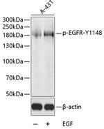 Phospho-EGFR (Tyr1148) Antibody in Western Blot (WB)