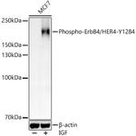 Phospho-ErbB4 (Tyr1284) Polyclonal Antibody