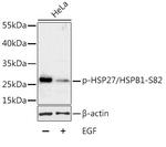 Phospho-HSP27 (Ser82) Antibody in Western Blot (WB)