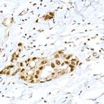 Phospho-Rb (Ser795) Polyclonal Antibody