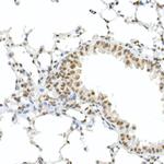 Phospho-Rb (Ser795) Antibody in Immunohistochemistry (Paraffin) (IHC (P))