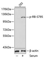 Phospho-Rb (Ser795) Antibody in Western Blot (WB)