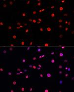 Phospho-Histone H3 (Thr11) Antibody in Immunocytochemistry (ICC/IF)