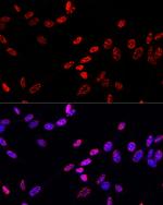 Phospho-Histone H3 (Thr11) Antibody in Immunocytochemistry (ICC/IF)
