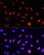 Phospho-Histone H3 (Thr11) Antibody in Immunocytochemistry (ICC/IF)