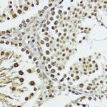 Phospho-Histone H3 (Thr11) Antibody in Immunohistochemistry (Paraffin) (IHC (P))