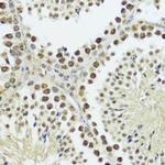 Phospho-Histone H3 (Thr11) Antibody in Immunohistochemistry (Paraffin) (IHC (P))