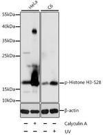 Phospho-Histone H3 (Ser28) Antibody in Western Blot (WB)