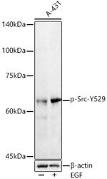 Phospho-SRC (Tyr529) Antibody in Western Blot (WB)