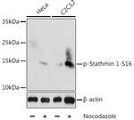 Phospho-Stathmin 1 (Ser16) Polyclonal Antibody