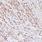 Phospho-BRCA1 (Ser1423) Antibody in Immunohistochemistry (Paraffin) (IHC (P))