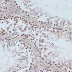 Phospho-BRCA1 (Ser1423) Antibody in Immunohistochemistry (Paraffin) (IHC (P))