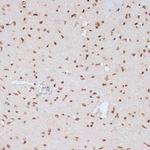 Phospho-ERK1 (Tyr204) Antibody in Immunohistochemistry (Paraffin) (IHC (P))