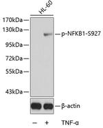 Phospho-NFkB p105 (Ser927) Polyclonal Antibody