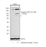 Phospho-STAT2 (Tyr690) Polyclonal Antibody