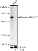 Phospho-FAK (Tyr397) Antibody in Western Blot (WB)