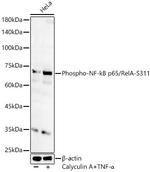 Phospho-NFkB p65 (Ser311) Polyclonal Antibody