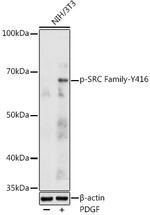 Phospho-SRC (Tyr416) Polyclonal Antibody