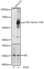 Phospho-SRC (Tyr416) Antibody in Western Blot (WB)