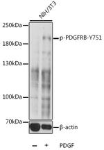 Phospho-PDGFRB (Tyr751) Polyclonal Antibody