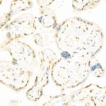 Phospho-c-Raf (Ser338) Polyclonal Antibody