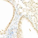 Phospho-c-Raf (Ser338) Antibody in Immunohistochemistry (Paraffin) (IHC (P))
