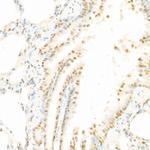 Phospho-c-Raf (Ser338) Antibody in Immunohistochemistry (Paraffin) (IHC (P))