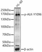 Phospho-ALK (Tyr1096) Antibody in Western Blot (WB)