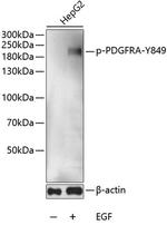Phospho-PDGFRA (Tyr849) Polyclonal Antibody