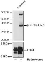 Phospho-CDK4 (Thr172) Antibody in Western Blot (WB)