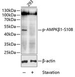 Phospho-AMPK beta-1 (Ser108) Antibody in Western Blot (WB)