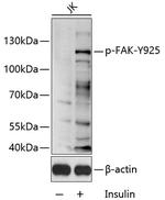 Phospho-FAK (Tyr925) Polyclonal Antibody