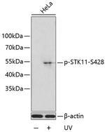 Phospho-LKB1 (Ser428) Antibody in Western Blot (WB)
