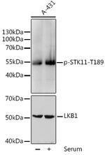 Phospho-LKB1 (Thr189) Polyclonal Antibody