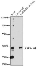 Phospho-EIF2S1 (Ser51) Antibody in Immunoprecipitation (IP)