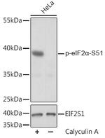 Phospho-EIF2S1 (Ser51) Polyclonal Antibody