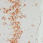 Phospho-VASP (Ser157) Antibody in Immunohistochemistry (Paraffin) (IHC (P))
