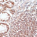 Phospho-VASP (Ser157) Polyclonal Antibody