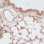 Phospho-VASP (Ser157) Antibody in Immunohistochemistry (Paraffin) (IHC (P))