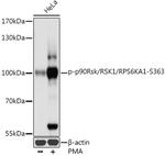 Phospho-RSK1 (Ser363) Antibody in Western Blot (WB)