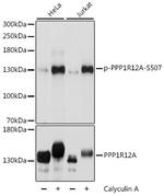 Phospho-MYPT1 (Ser507) Polyclonal Antibody