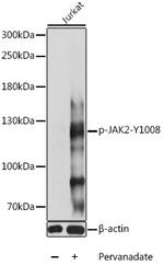 Phospho-JAK2 (Tyr1008) Polyclonal Antibody