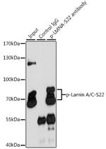 Phospho-Lamin A/C (Ser22) Antibody in Immunoprecipitation (IP)