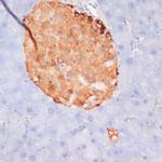 Phospho-ATP Citrate Lyase (Ser455) Polyclonal Antibody