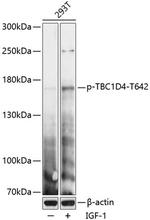 Phospho-AS160 (Thr642) Polyclonal Antibody